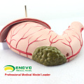 STOMACH04(12537) Human Stomach Model Gastric Disease Model for Medical Science Study